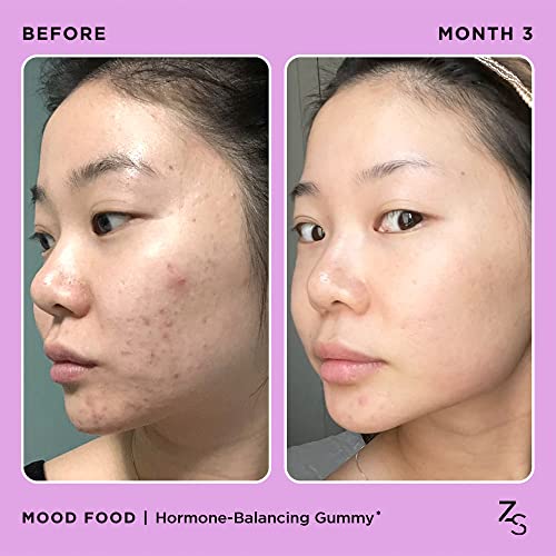 ZitSticka Mood Food: Gummy for Moody Skin + PMS Drama, Forest Berry Flavour ZitSticka